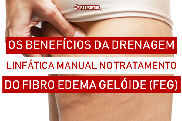 Os Benefícios da Drenagem Linfática Manual no Tratamento do Fibro Edema  Gelóide (Celulite) – Resportes Cursos